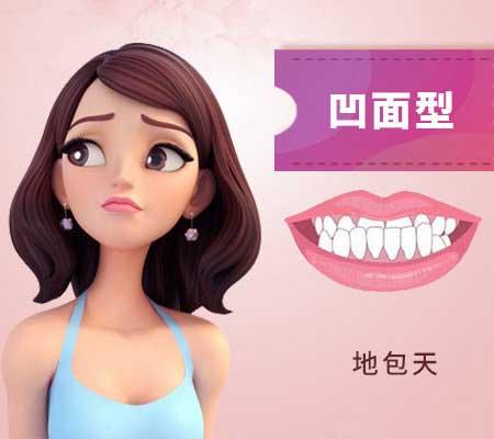 什么是地包天？地包天長什么樣子？地包天牙齒圖片
