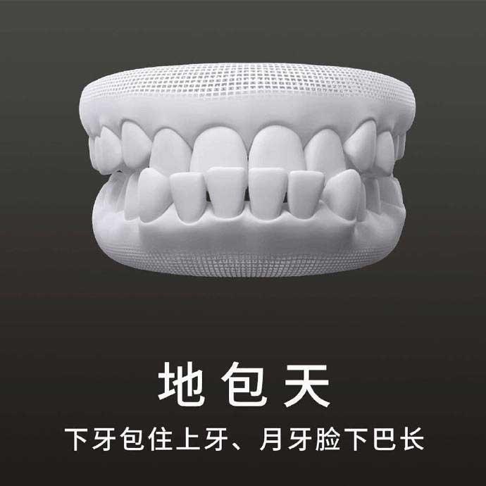 什么是地包天？地包天長什么樣子？地包天牙齒圖片